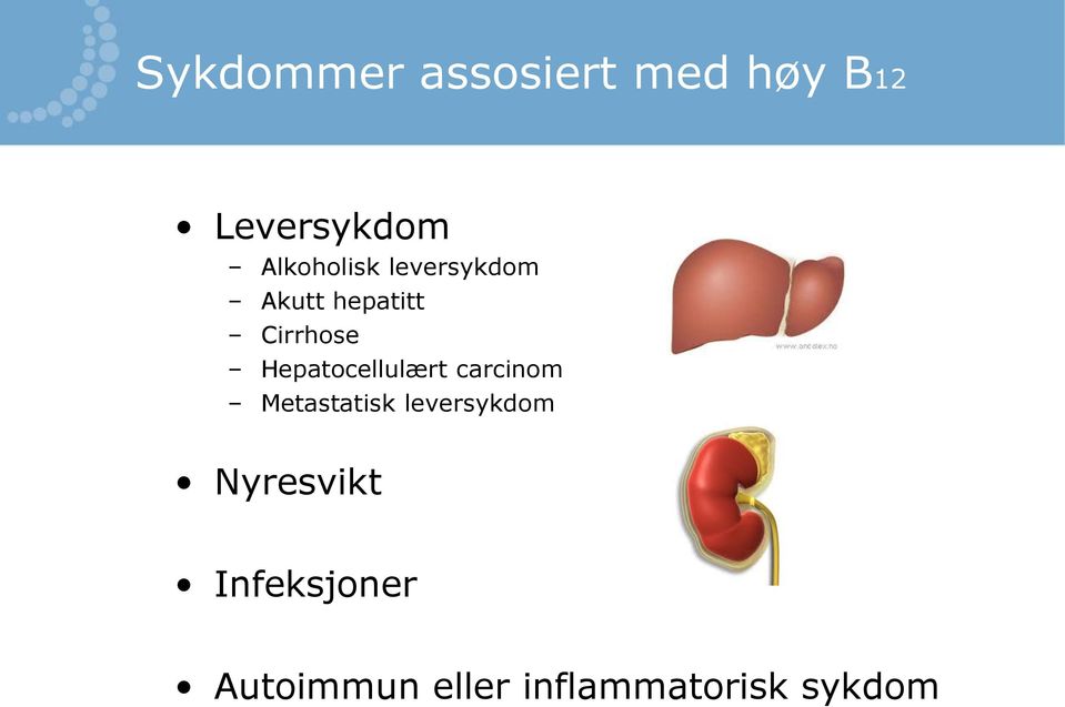 Hepatocellulært carcinom Metastatisk leversykdom