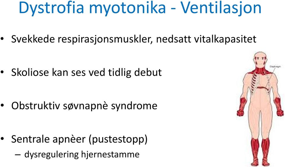 Skoliose kan ses ved tidlig debut Obstruktiv