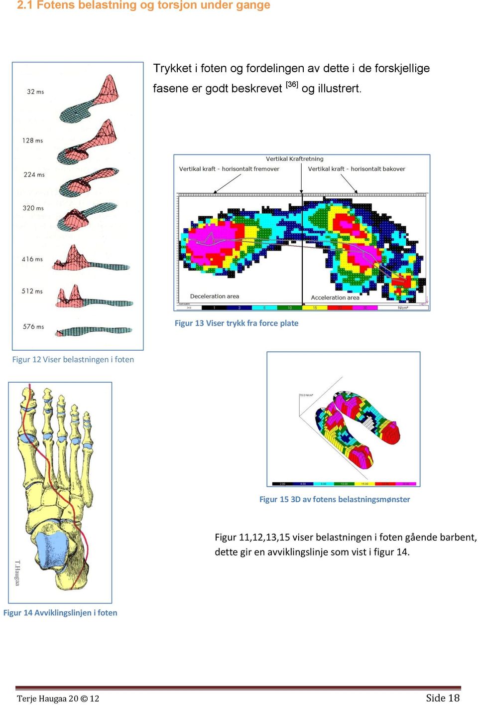 Figur 13 Viser trykk fra force plate Figur 12 Viser belastningen i foten Figur 15 3D av fotens