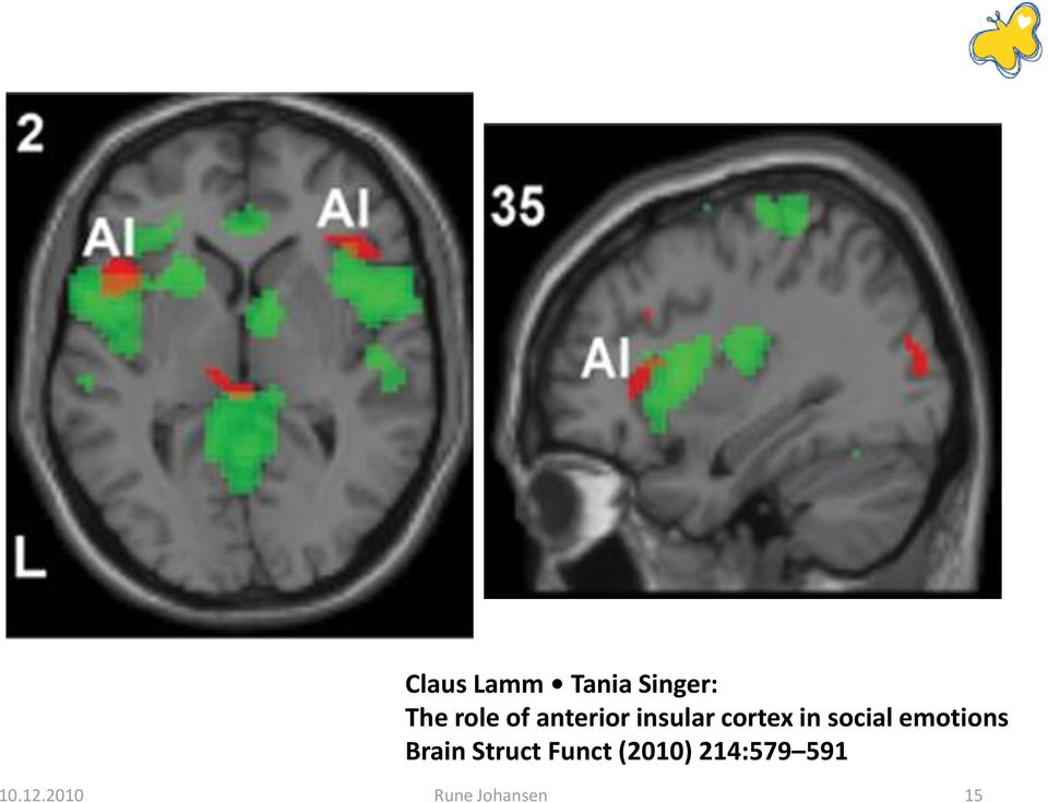emotions Brain Struct Funct (2010)