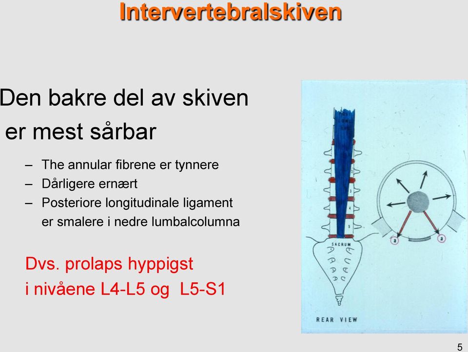 Posteriore longitudinale ligament er smalere i nedre