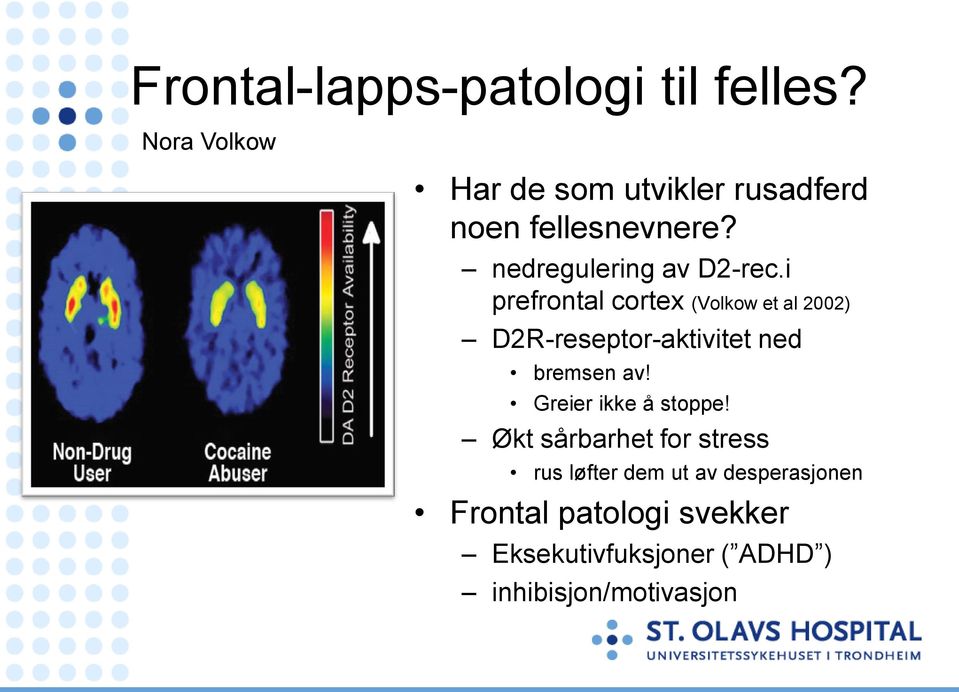 i prefrontal cortex (Volkow et al 2002) D2R-reseptor-aktivitet ned bremsen av!