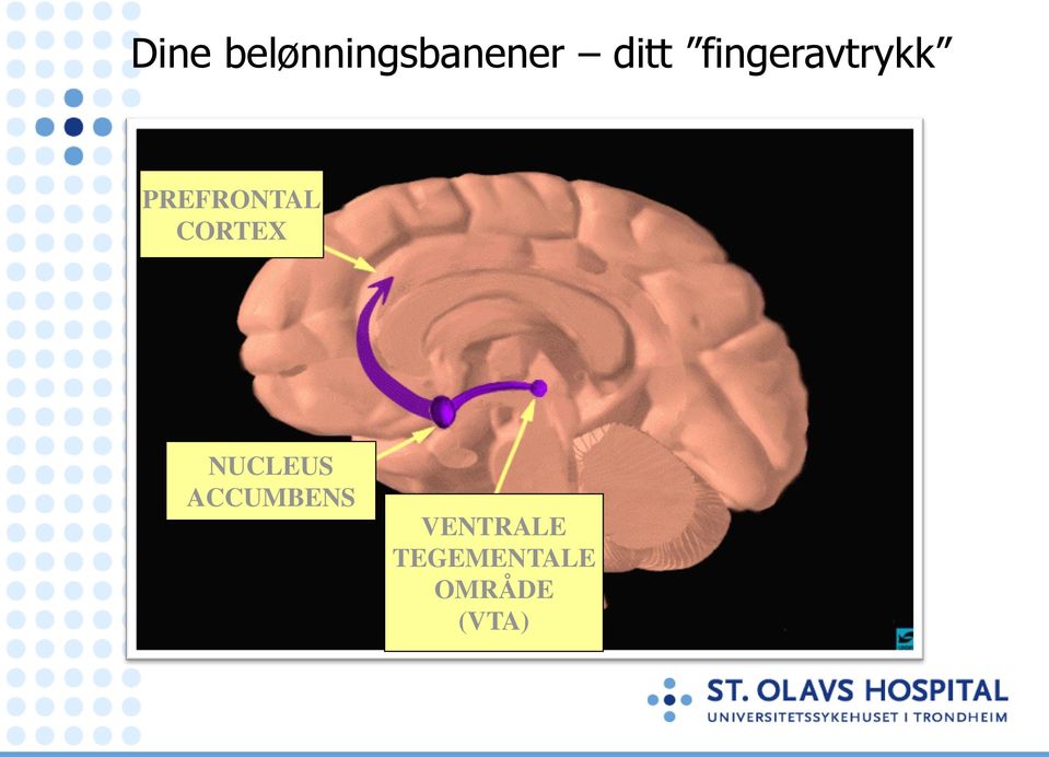 CORTEX NUCLEUS ACCUMBENS