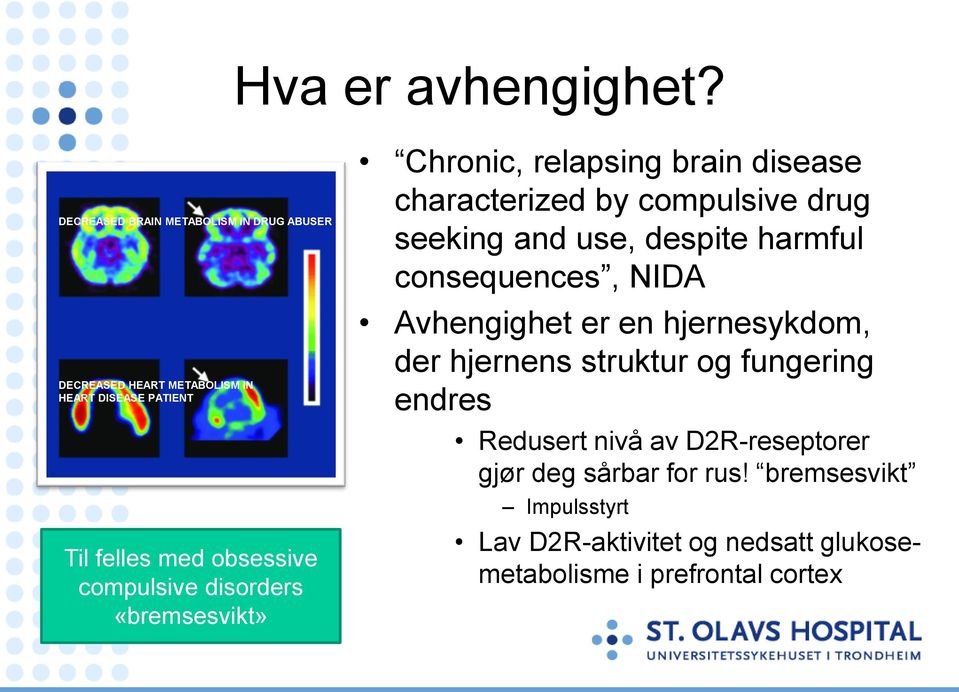 compulsive disorders «bremsesvikt» Chronic, relapsing brain disease characterized by compulsive drug seeking and use, despite