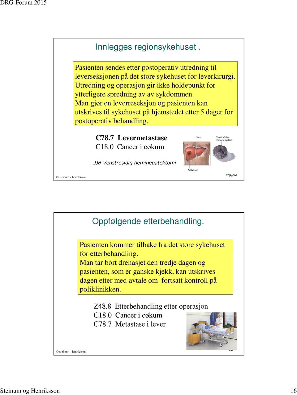 Man gjør en leverreseksjon og pasienten kan utskrives til sykehuset på hjemstedet etter 5 dager for postoperativ behandling. C78.7 Levermetastase C18.