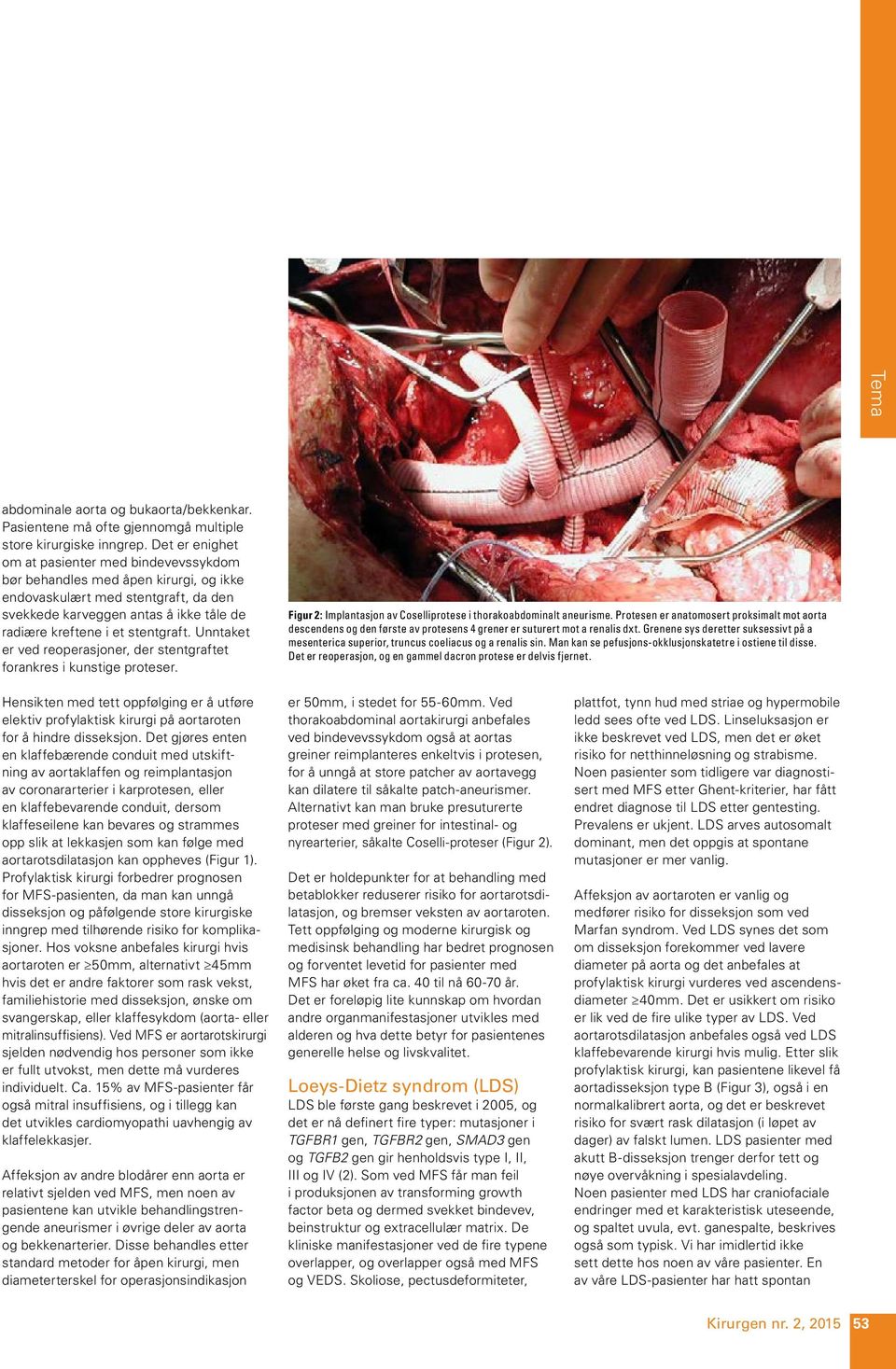 stentgraft. Unntaket er ved reoperasjoner, der stentgraftet forankres i kunstige proteser. Figur 2: Implantasjon av Coselliprotese i thorakoabdominalt aneurisme.