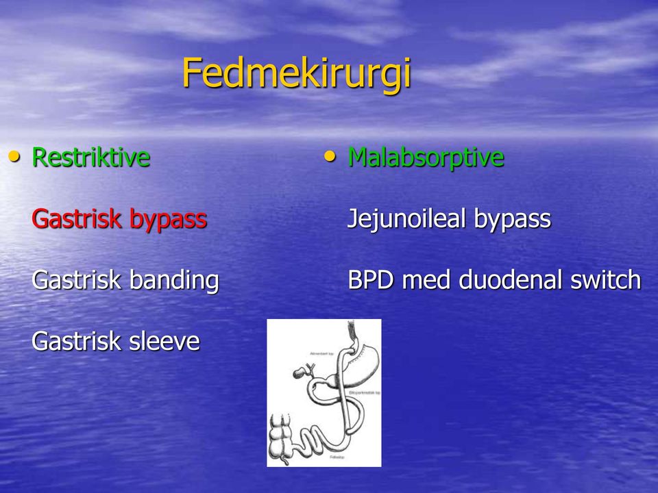 Malabsorptive Jejunoileal bypass