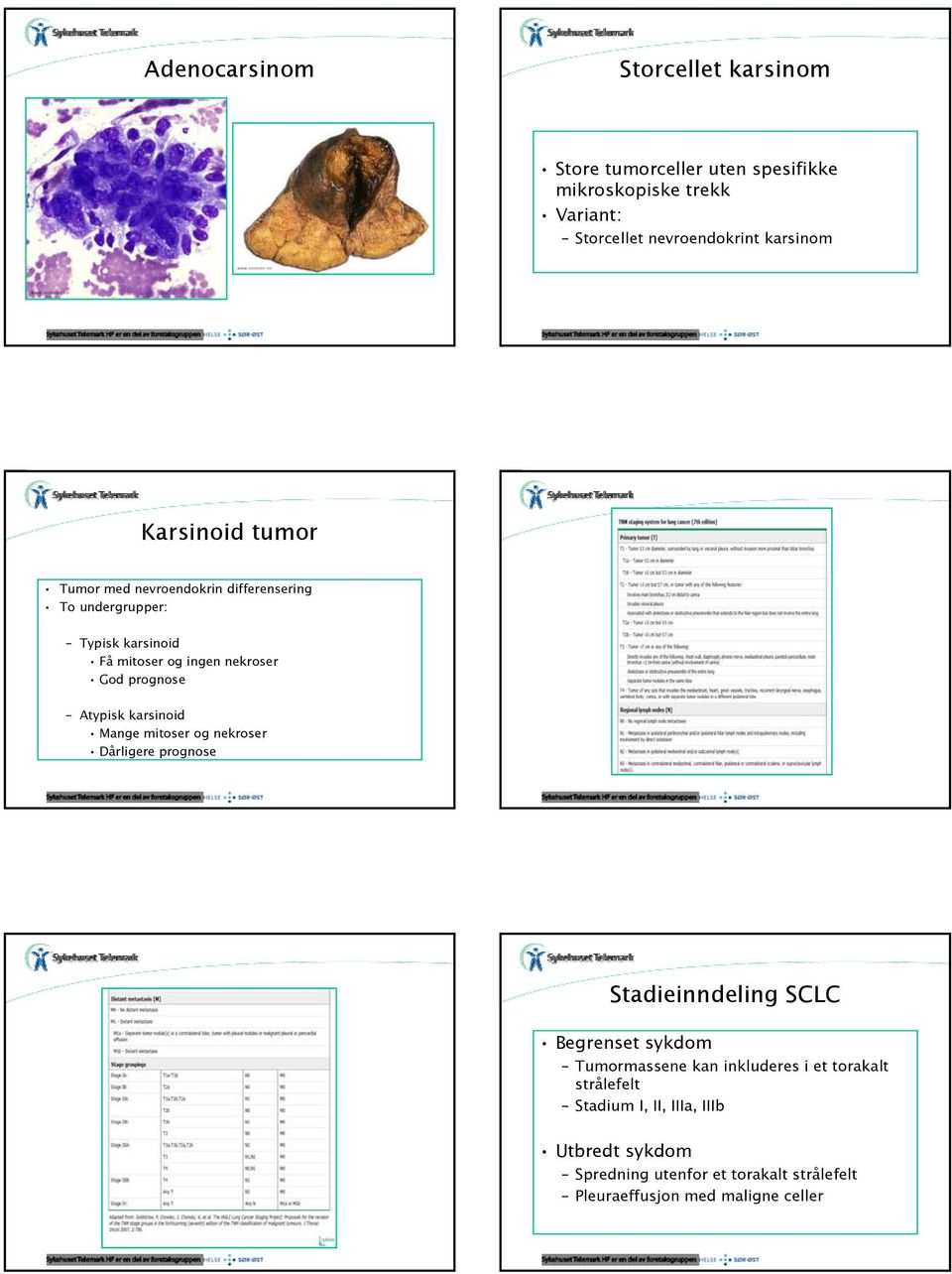Atypisk karsinoid Mange mitoserog nekroser Dårligere prognose Stadieinndeling SCLC Begrenset sykdom Tumormassene kan inkluderes i et