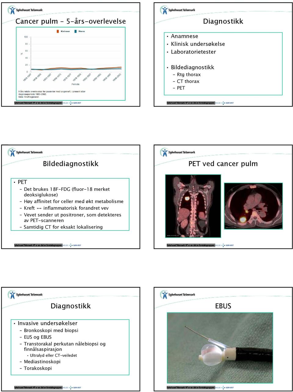 inflammatorisk forandret vev Vevet sender ut positroner, som detekteres av PET-scanneren Samtidig CT for eksakt lokalisering Diagnostikk EBUS