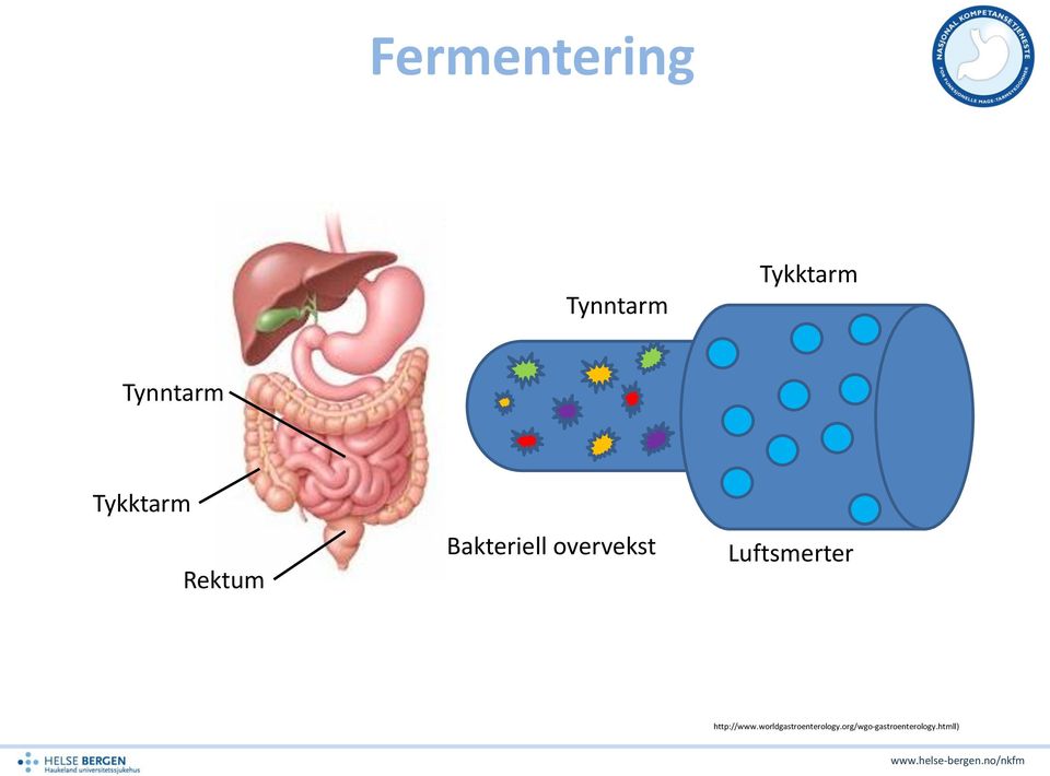 overvekst Luftsmerter http://www.