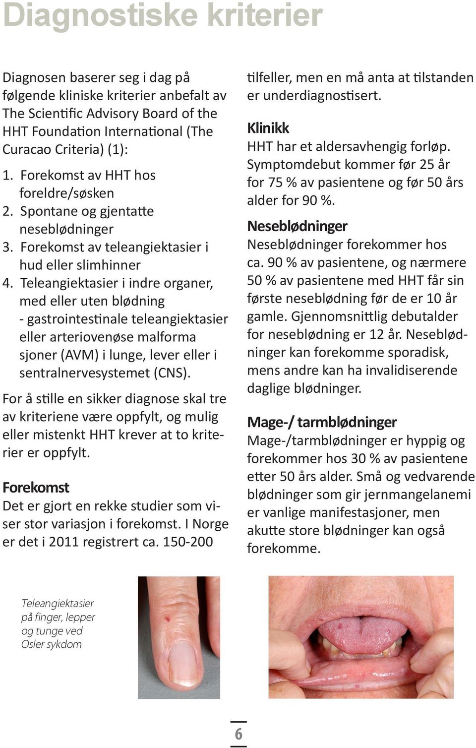 Teleangiektasier i indre organer, med eller uten blødning - gastro intestinale teleangiektasier eller arteriovenøse malforma sjoner (AVM) i lunge, lever eller i sentralnervesystemet (CNS).