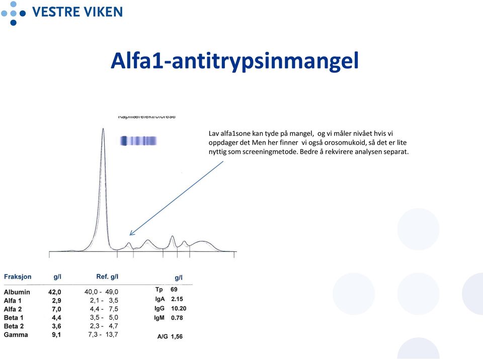 her finner vi også orosomukoid, så det er lite