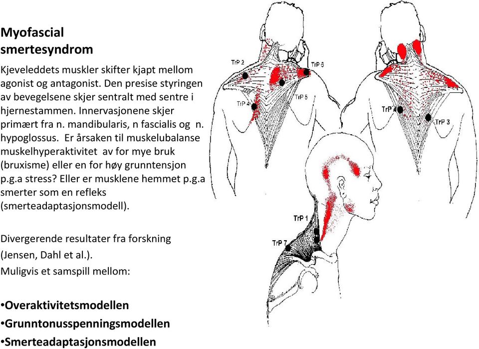 hypoglossus. Er årsaken til muskelubalanse muskelhyperaktivitet av for mye bruk (bruxisme) eller en for høy grunntensjon p.g.a stress?