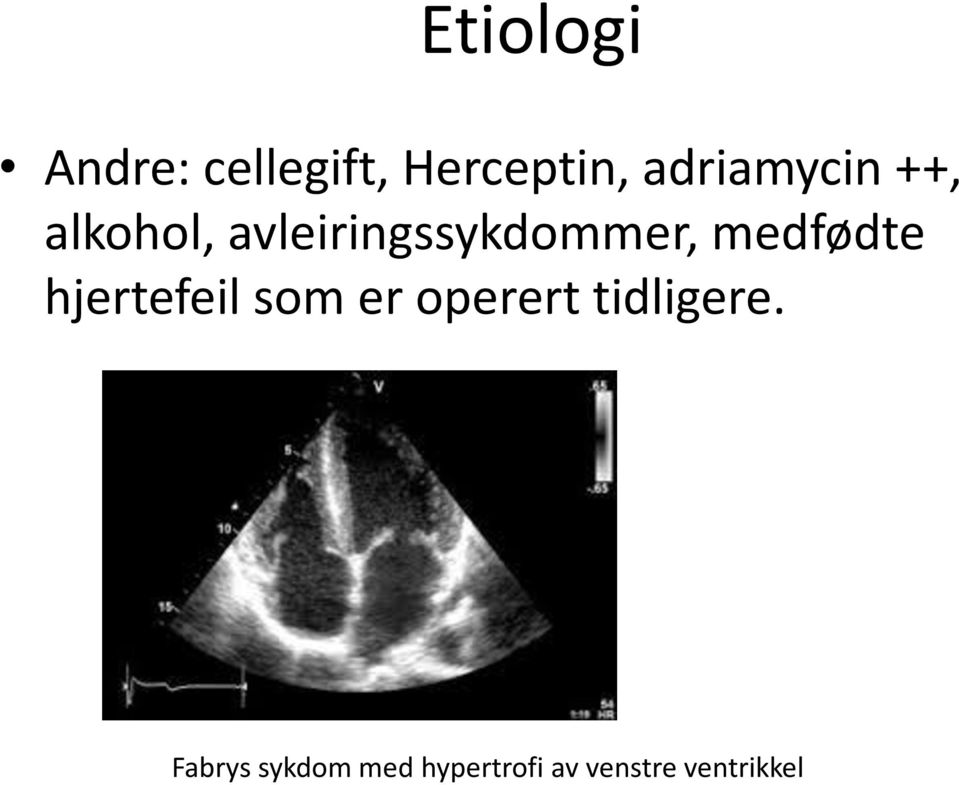 medfødte hjertefeil som er operert tidligere.