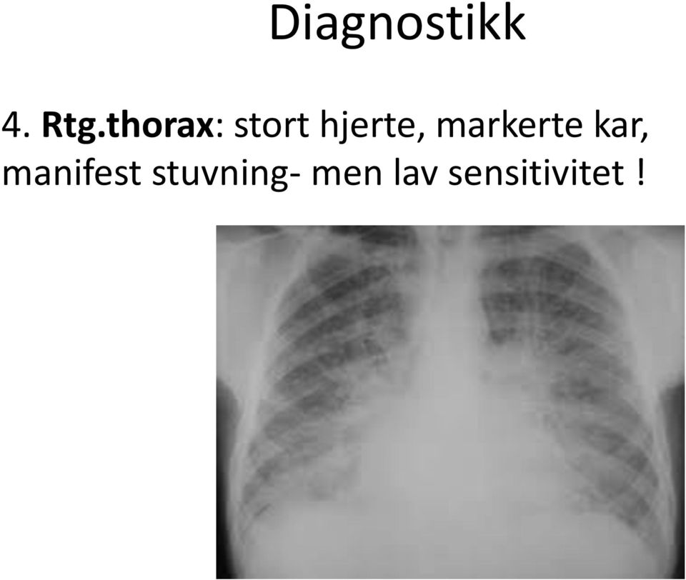 markerte kar, manifest