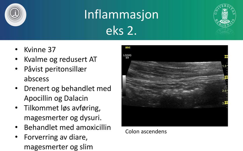 Drenert og behandlet med Apocillin og Dalacin Tilkommet løs