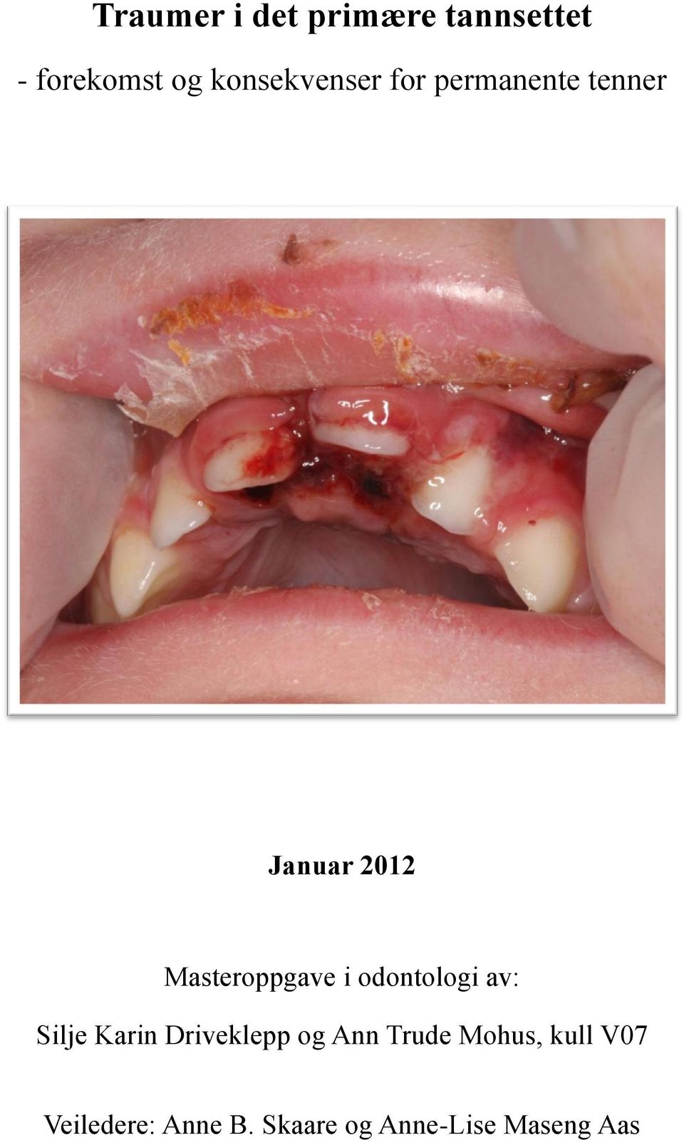 Masteroppgave i odontologi av: Silje Karin Driveklepp og