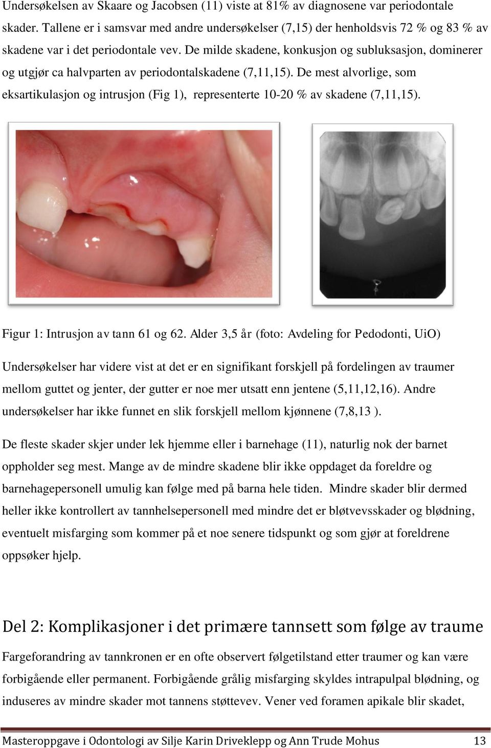 De milde skadene, konkusjon og subluksasjon, dominerer og utgjør ca halvparten av periodontalskadene (7,11,15).