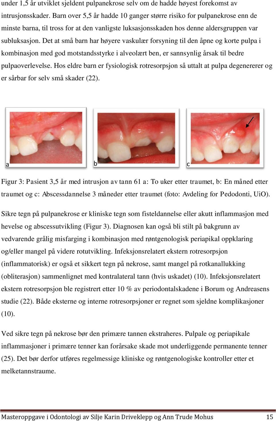 Det at små barn har høyere vaskulær forsyning til den åpne og korte pulpa i kombinasjon med god motstandsstyrke i alveolært ben, er sannsynlig årsak til bedre pulpaoverlevelse.