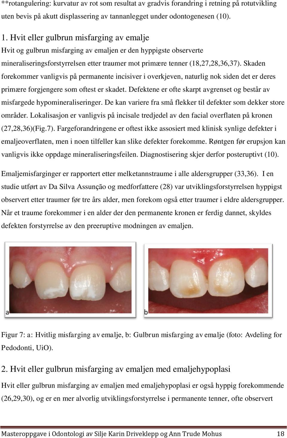 Skaden forekommer vanligvis på permanente incisiver i overkjeven, naturlig nok siden det er deres primære forgjengere som oftest er skadet.