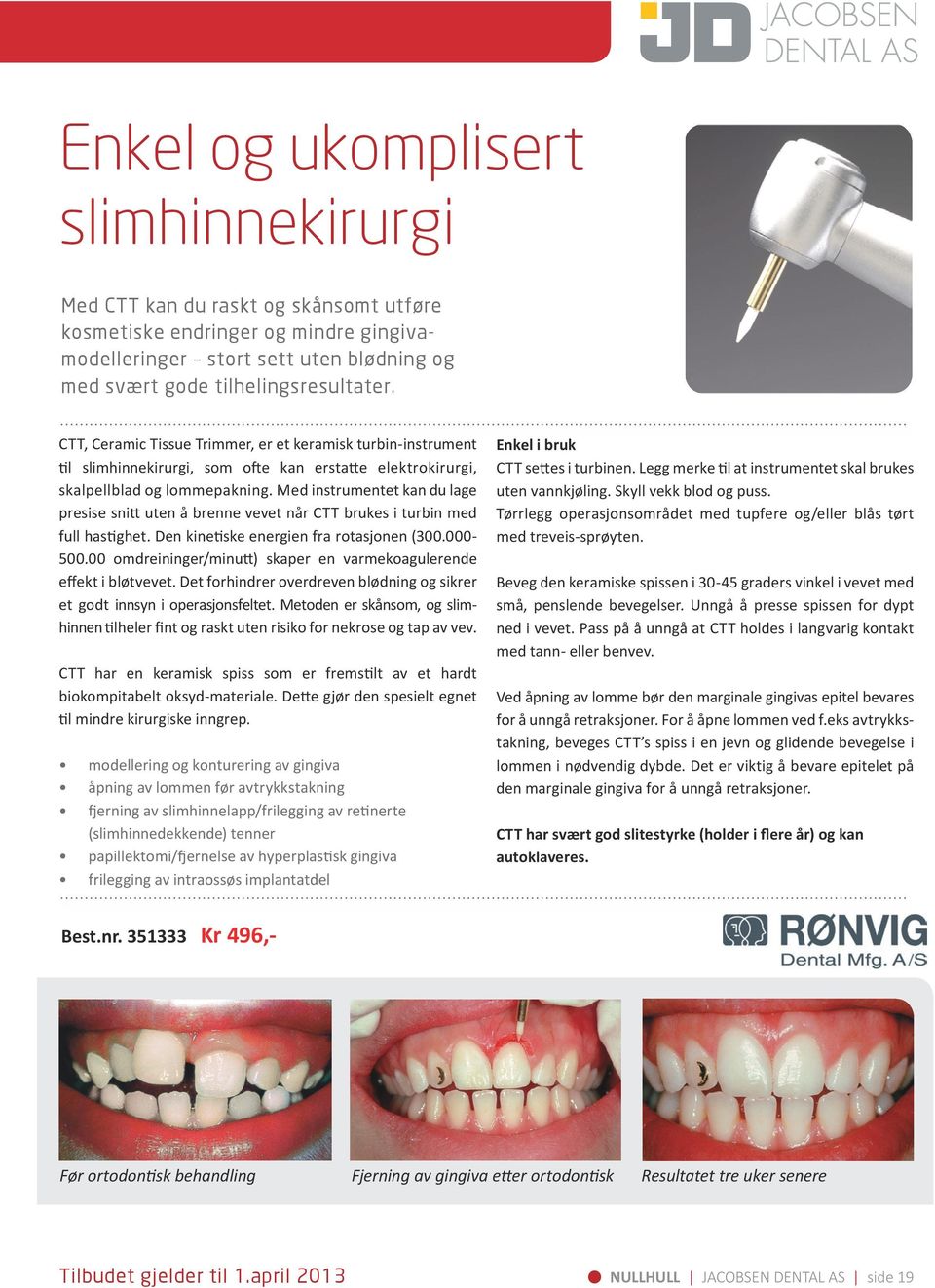 Med instrumentet kan du lage presise snitt uten å brenne vevet når CTT brukes i turbin med full hastighet. Den kinetiske energien fra rotasjonen (300.000-500.