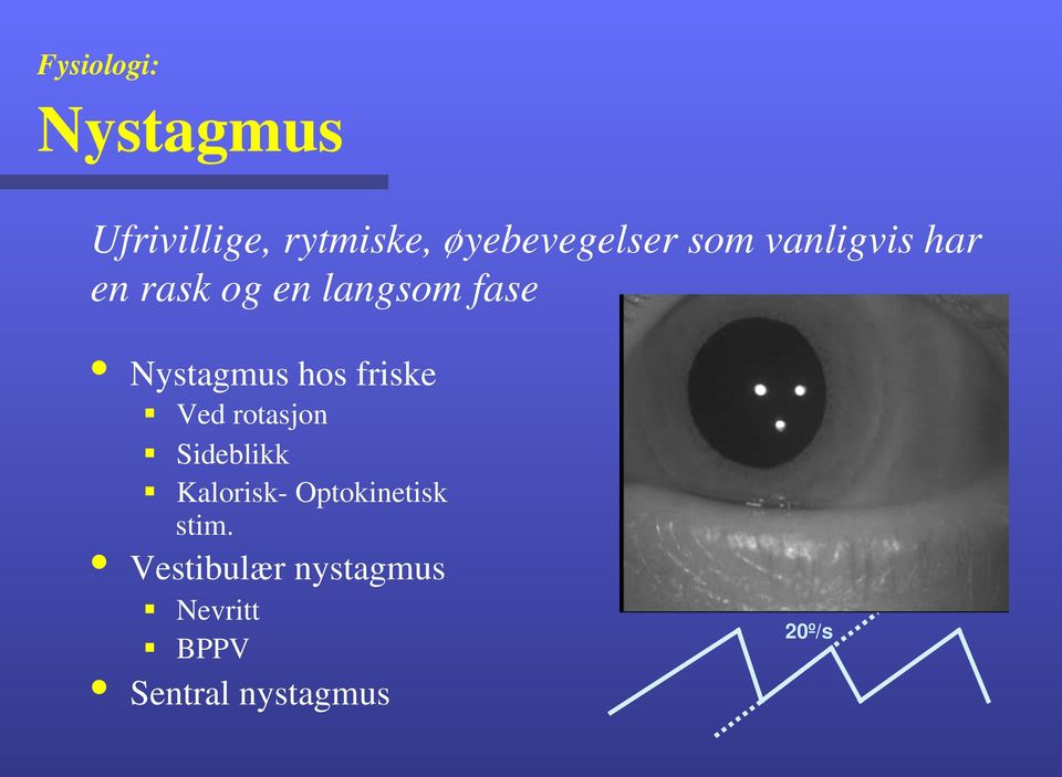 Nystagmus hos friske!! Ved rotasjon!! Sideblikk!