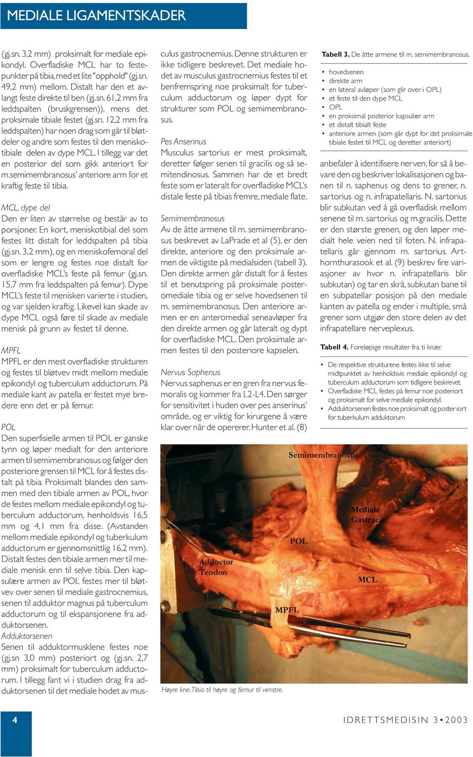 I tillegg var det en posterior del som gikk anteriort for m.semimembranosus anteriore arm for et kraftig feste til tibia. MCL, dype del Den er liten av størrelse og består av to porsjoner.