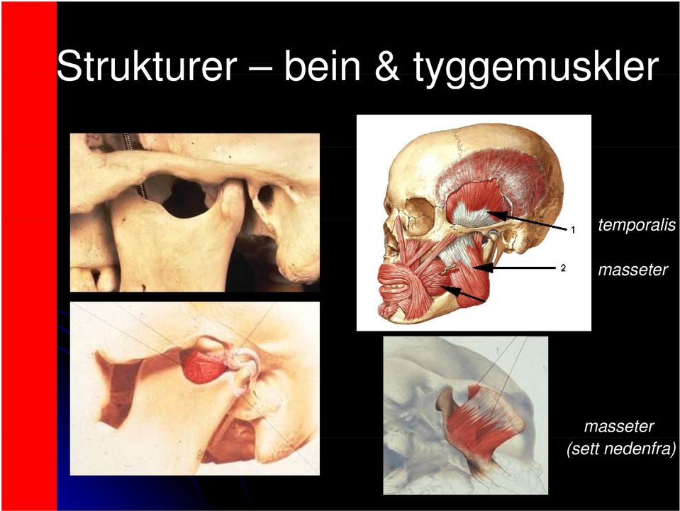 temporalis