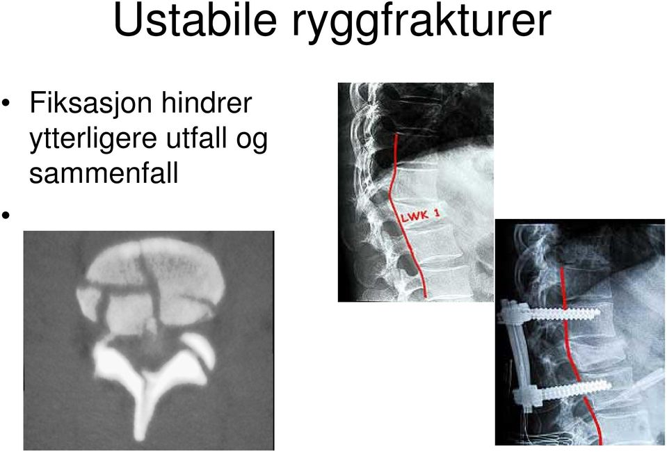 Fiksasjon hindrer