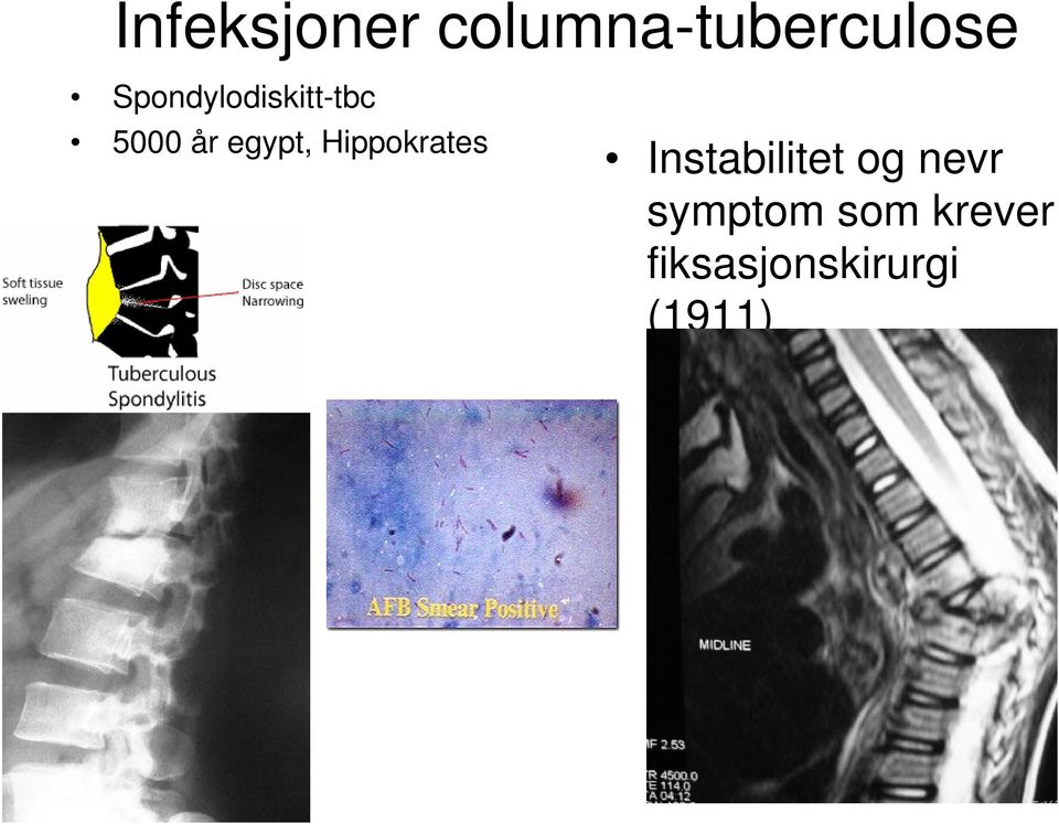 Hippokrates Instabilitet og nevr