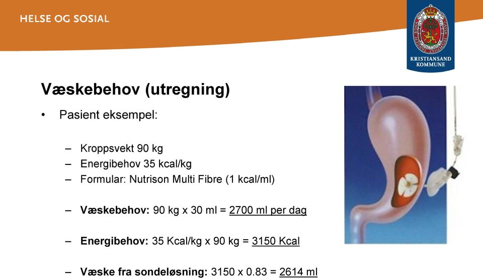 kcal/ml) Væskebehov: 90 kg x 30 ml = 2700 ml per dag