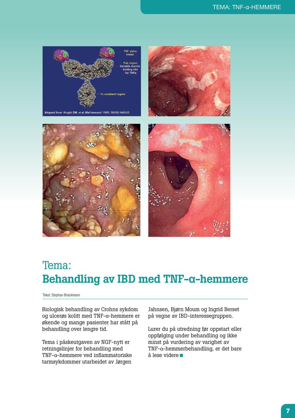 Tema i påskeutgaven av NGF-nytt er retningslinjer for behandling med TNF-α-hemmere ved inflammatoriske tarmsykdommer utarbeidet av Jørgen Jahnsen,