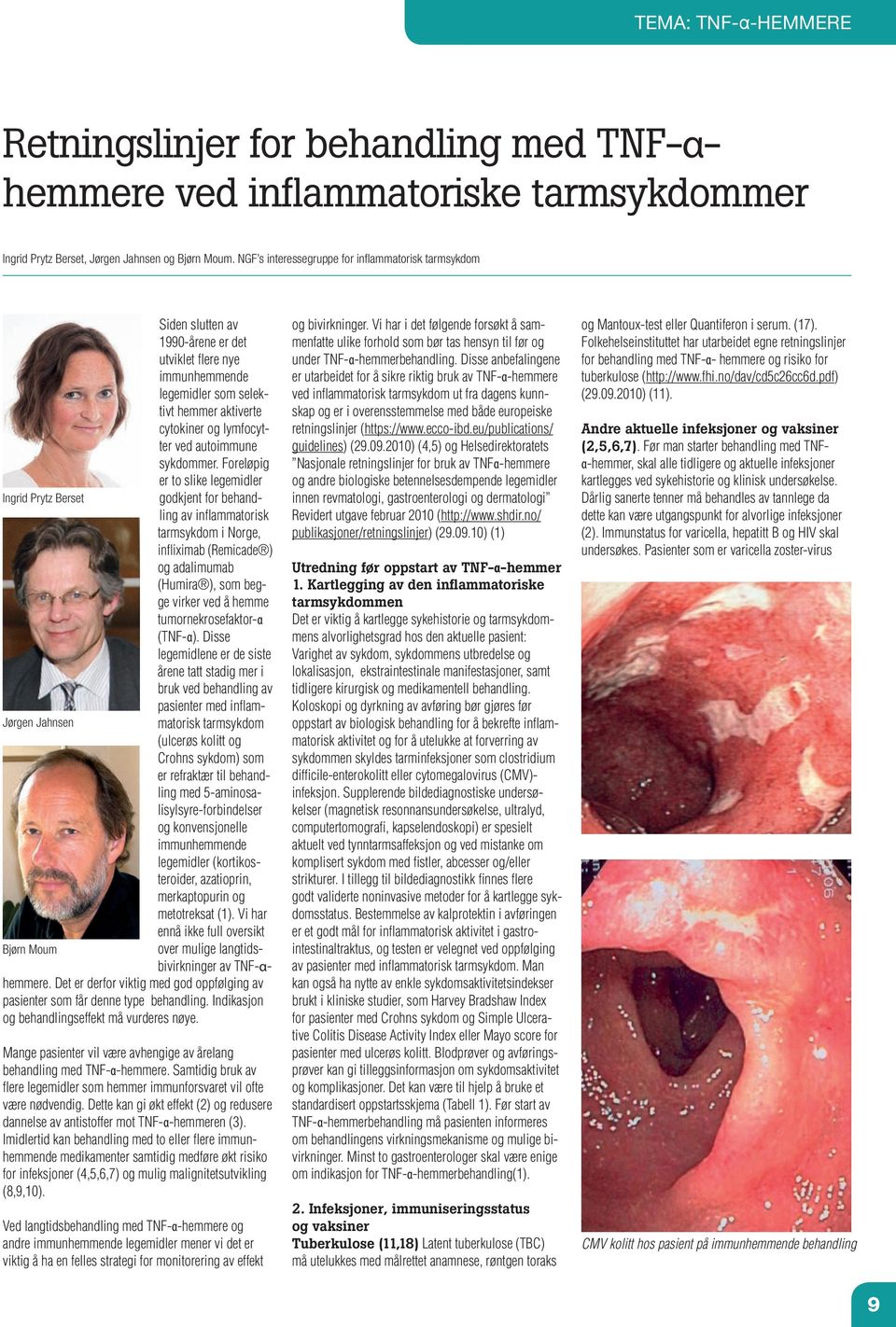 autoimmune sykdommer.