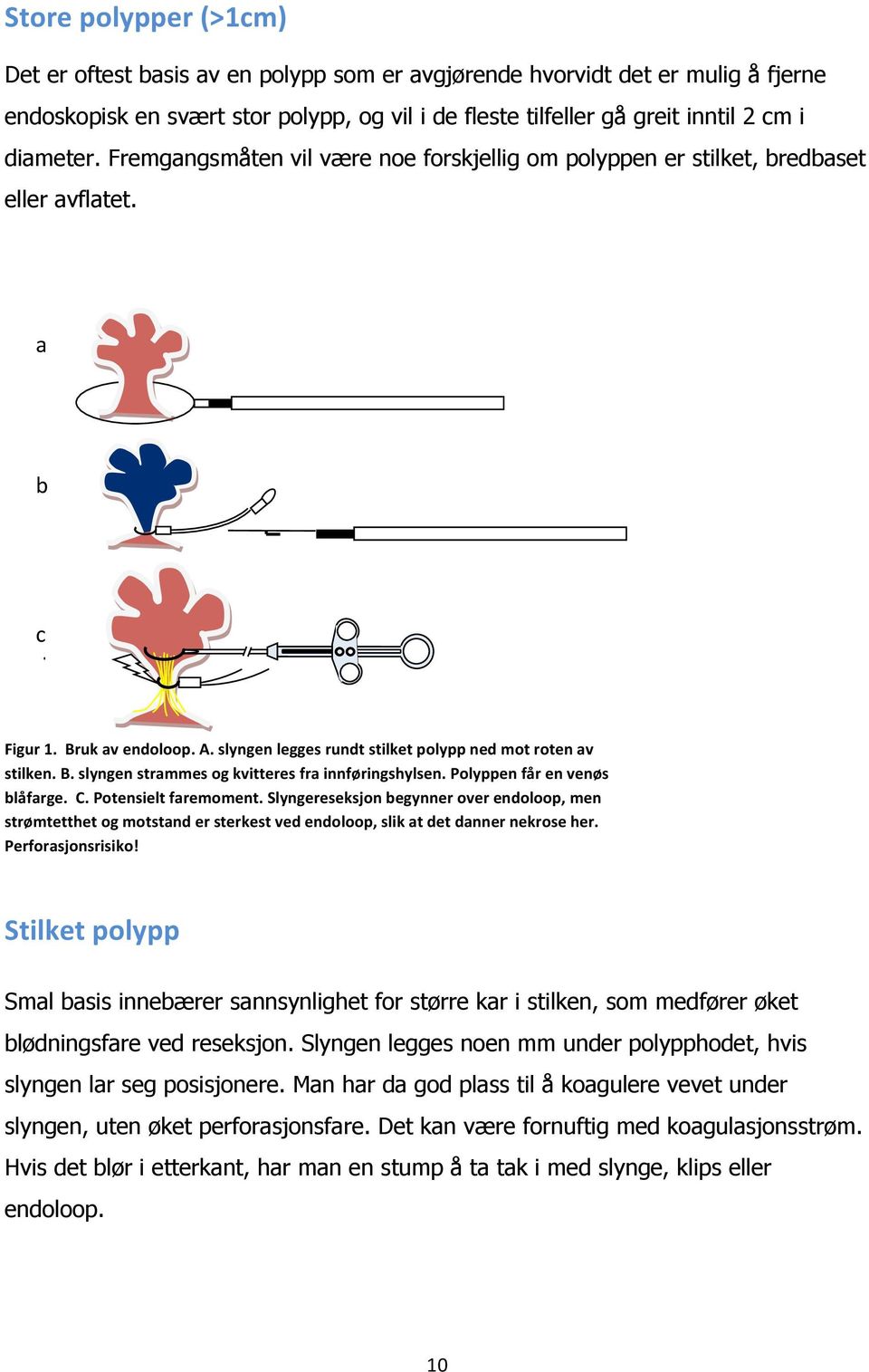 B. slyngen strammes og kvitteres fra innføringshylsen. Polyppen får en venøs blåfarge. C. Potensielt faremoment.