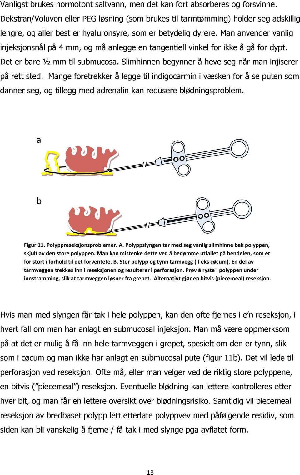 Man anvender vanlig injeksjonsnål på 4 mm, og må anlegge en tangentiell vinkel for ikke å gå for dypt. Det er bare ½ mm til submucosa. Slimhinnen begynner å heve seg når man injiserer på rett sted.