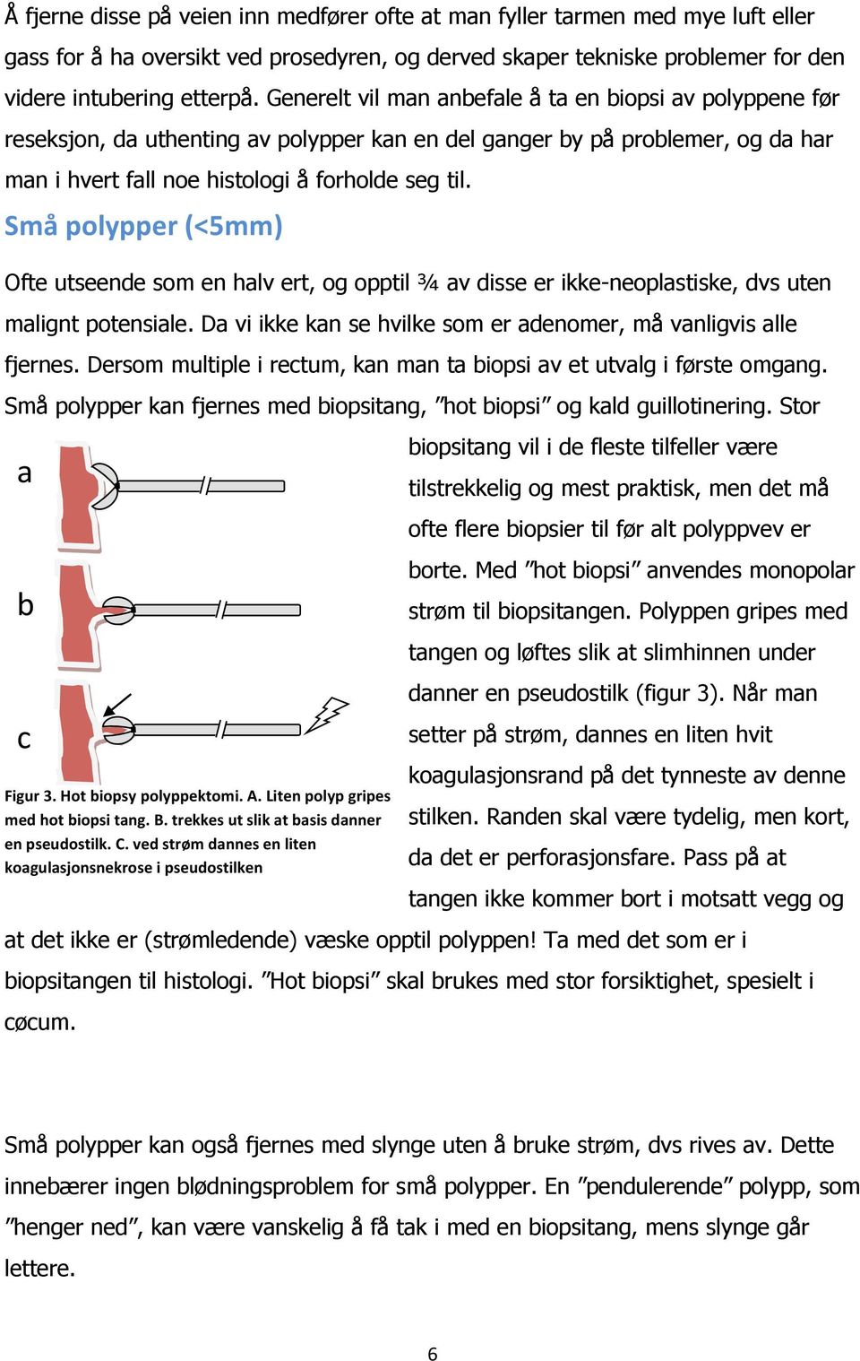 Små polypper (<5mm) Ofte utseende som en halv ert, og opptil ¾ av disse er ikke-neoplastiske, dvs uten malignt potensiale. Da vi ikke kan se hvilke som er adenomer, må vanligvis alle fjernes.