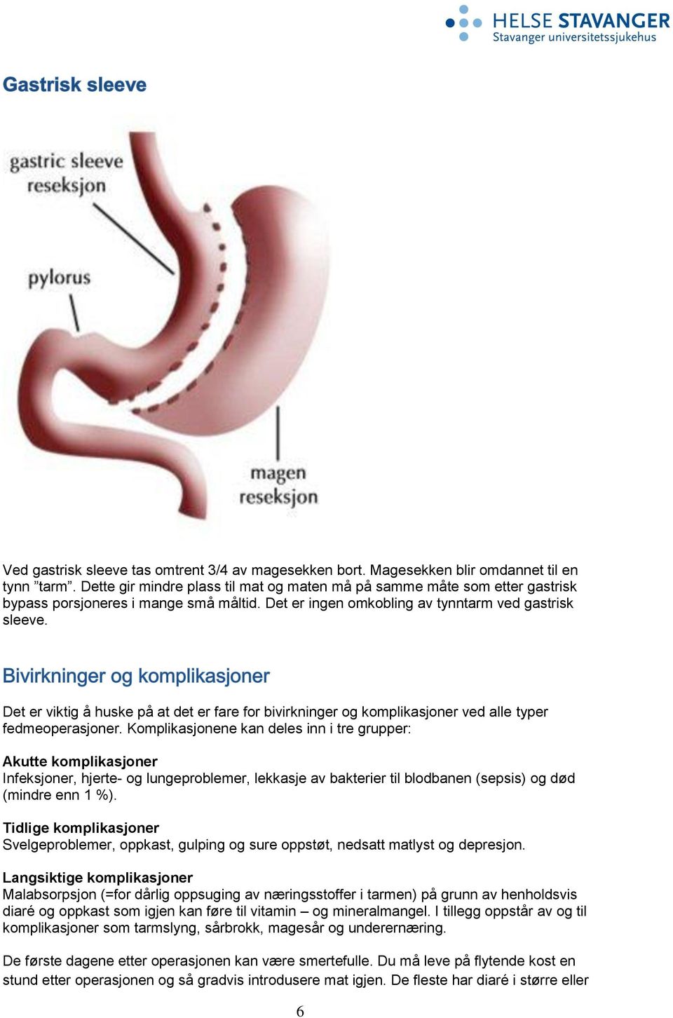 Det er viktig å huske på at det er fare for bivirkninger og komplikasjoner ved alle typer fedmeoperasjoner.