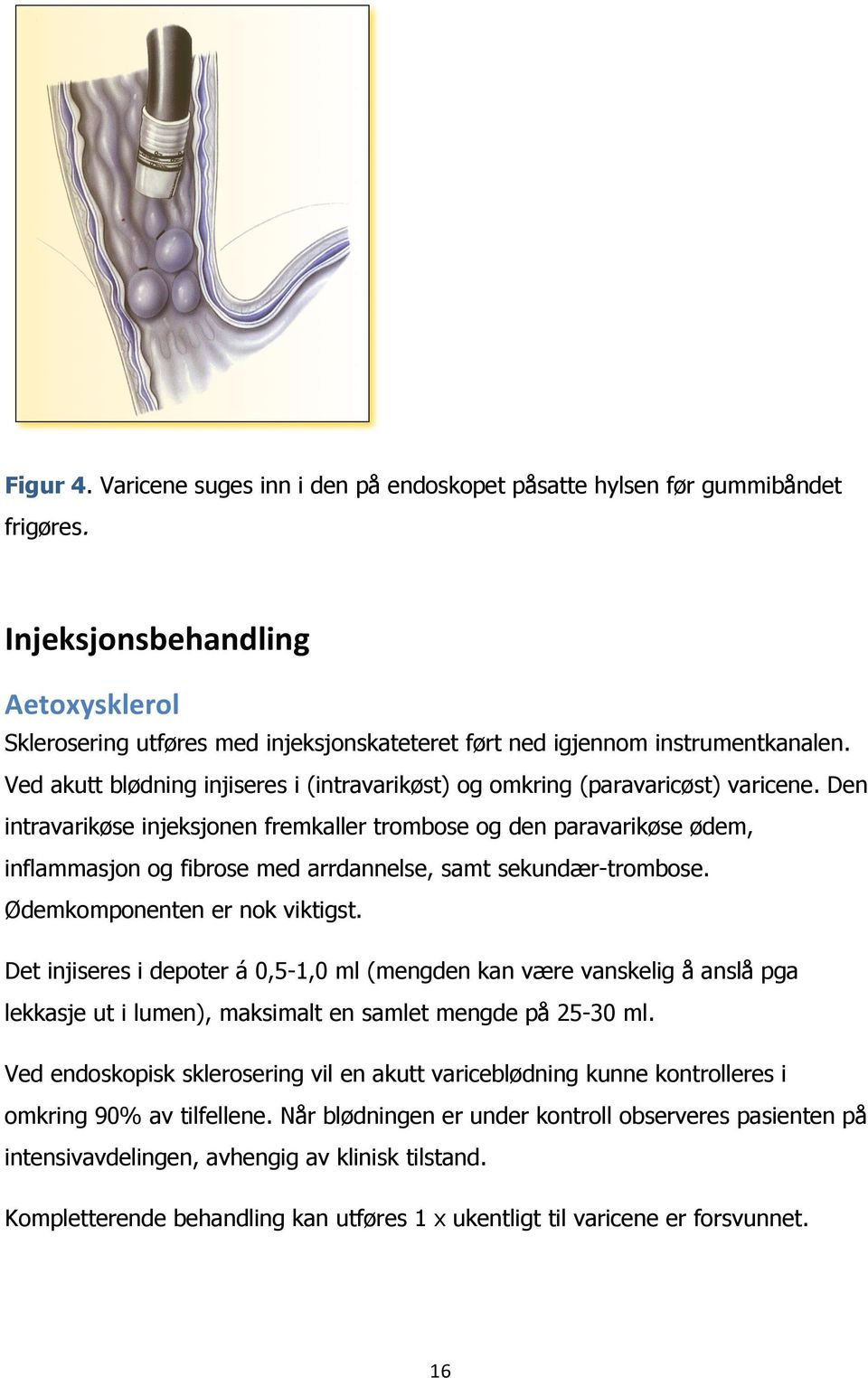 Den intravarikøse injeksjonen fremkaller trombose og den paravarikøse ødem, inflammasjon og fibrose med arrdannelse, samt sekundær-trombose. Ødemkomponenten er nok viktigst.