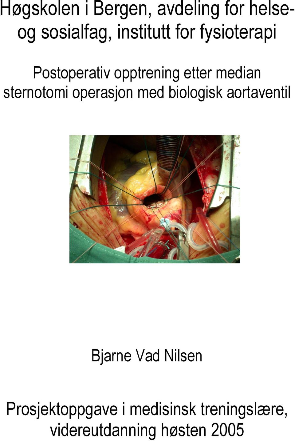 sternotomi operasjon med biologisk aortaventil Bjarne Vad
