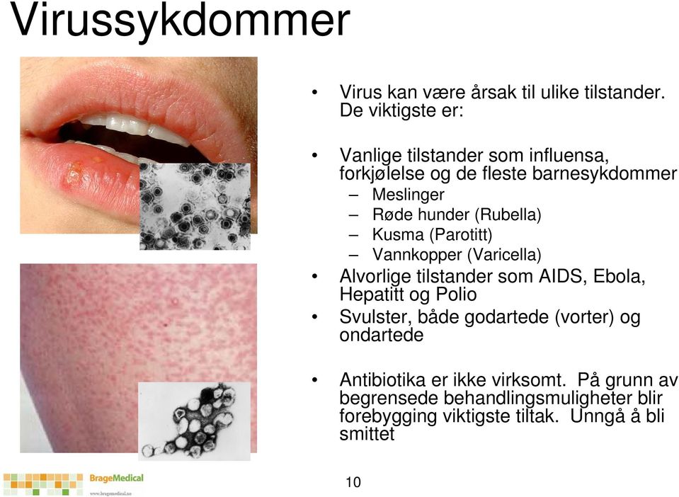 (Rubella) Kusma (Parotitt) Vannkopper (Varicella) Alvorlige tilstander som AIDS, Ebola, Hepatitt og Polio