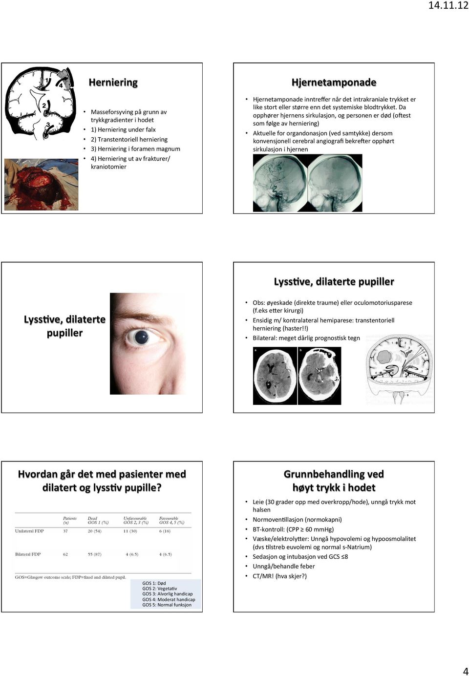 Da opphører hjernens sirkulasjon, og personen er død (okest som følge av herniering) Aktuelle for organdonasjon (ved samtykke) dersom konvensjonell cerebral angiografi bekreker opphørt sirkulasjon i