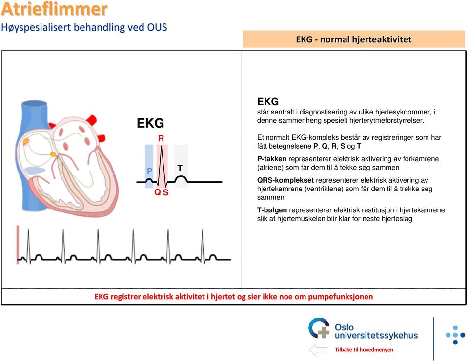 får dem til å tekke seg sammen QRS-komplekset representerer elektrisk aktivering av hjertekamrene (ventriklene) som får dem til å trekke seg sammen T-bølgen