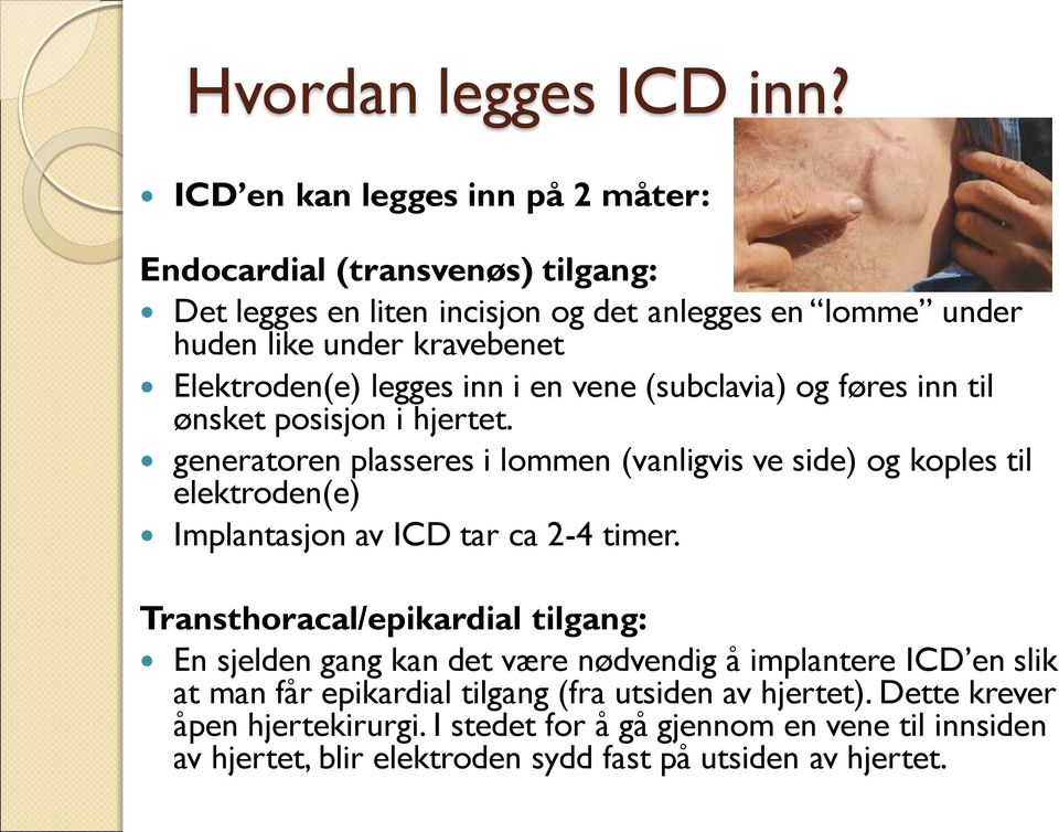 legges inn i en vene (subclavia) og føres inn til ønsket posisjon i hjertet.