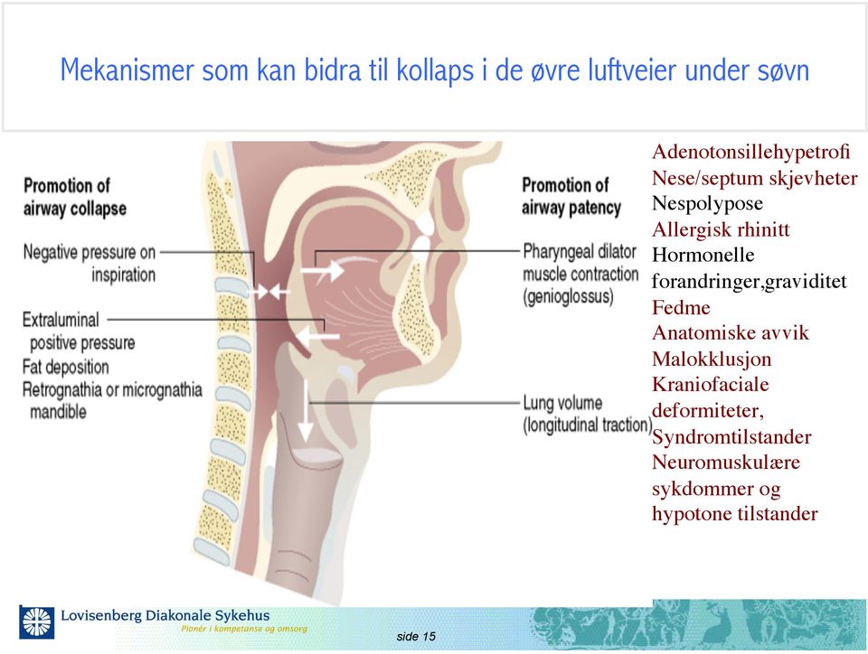 Hormonelle forandringer,graviditet Fedme Anatomiske avvik Malokklusjon