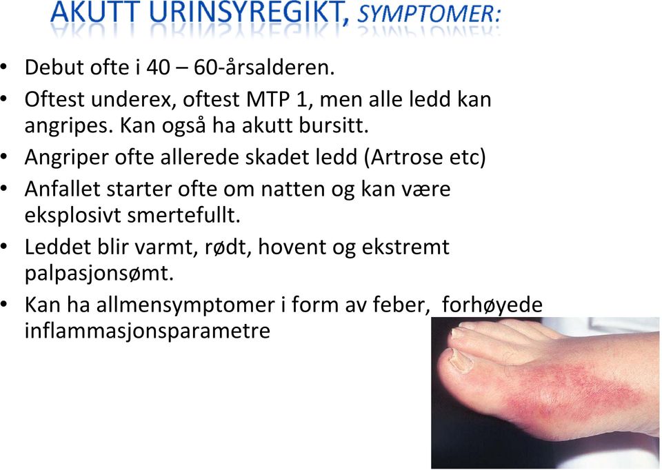 Angriper ofte allerede skadet ledd (Artrose etc) Anfallet starter ofte om natten og kan