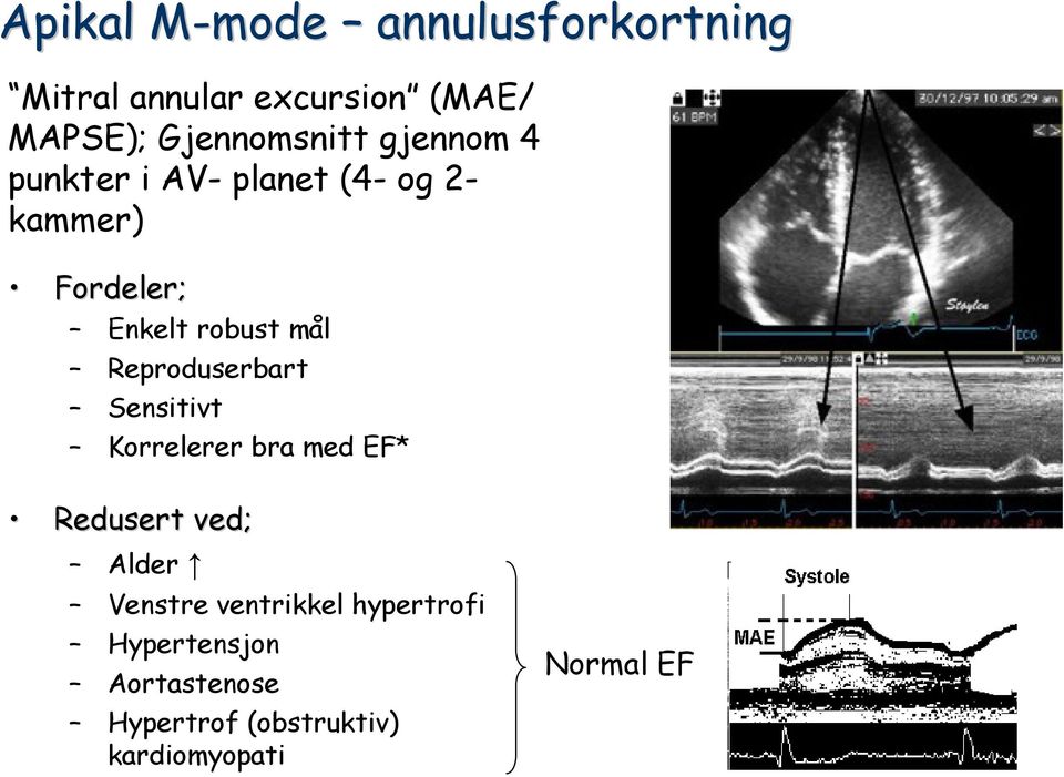 robust mål Reproduserbart Sensitivt Korrelerer bra med EF* Redusert ved; Alder