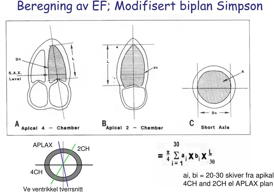 ventrikkel tverrsnitt ai, bi =