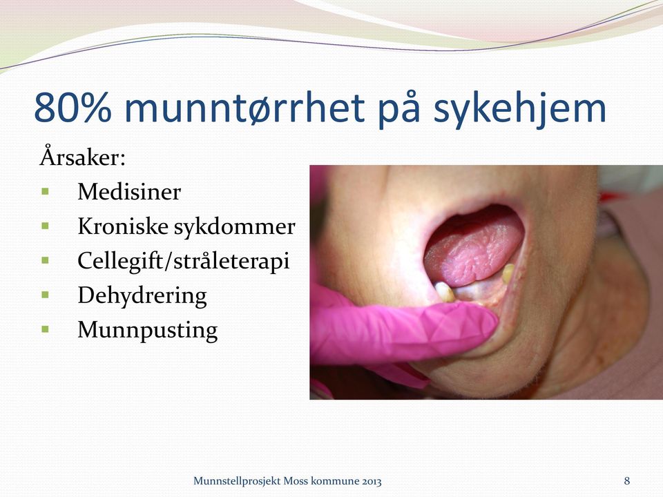 Cellegift/stråleterapi Dehydrering