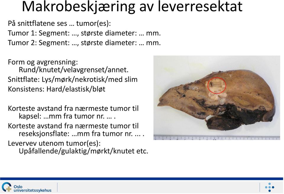 Snittflate: Lys/mørk/nekrotisk/med slim Konsistens: Hard/elastisk/bløt Korteste avstand fra nærmeste tumor til kapsel: