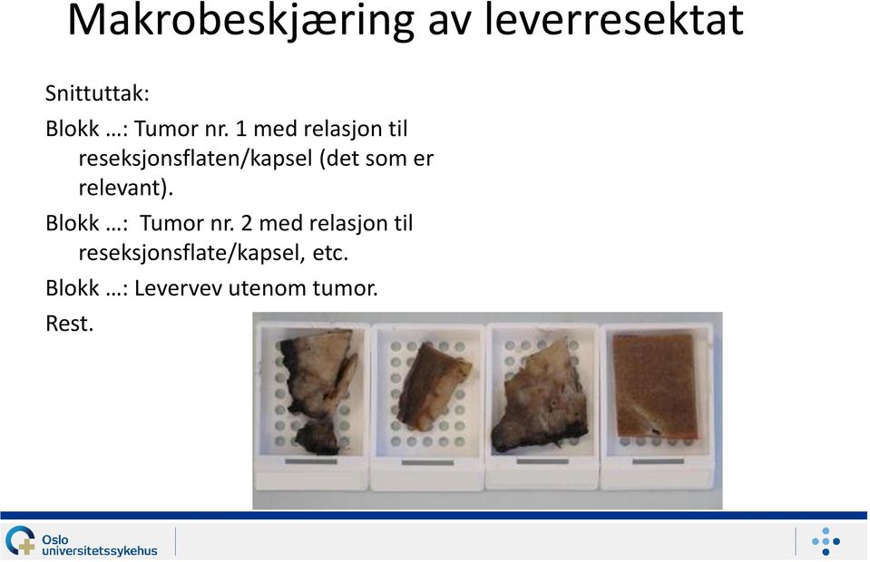 1 med relasjon til reseksjonsflaten/kapsel (det som er